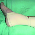 СУПРАСОРБ P (SUPRASORB P) ПОЛИУРЕТАНОВАЯ ГУБКА image