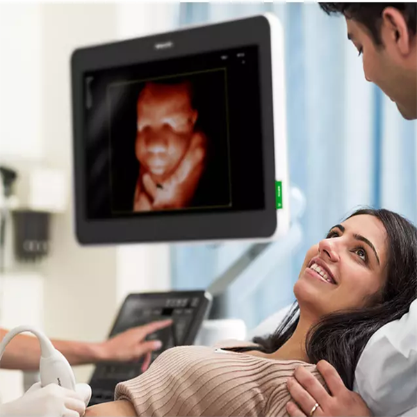 УЛЬТРАЗВУКОВАЯ СИСТЕМА ПРЕМИУМ КЛАССА PHILIPS EPIQ ELITE image