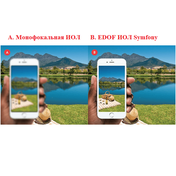 ЛИНЗА С ПРОЛОНГИРОВАННЫМ ФОКУСОМ ИНТРАОКУЛЯРНАЯ (IOL) TECNIS SYMFONY image