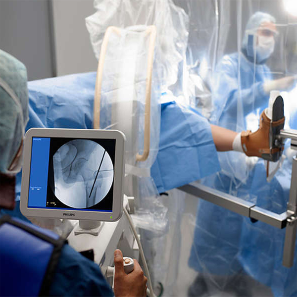 BV PULSERA ПЕРЕДВИЖНОЙ РЕНТГЕНХИРУРГИЧЕСКИЙ АППАРАТ image