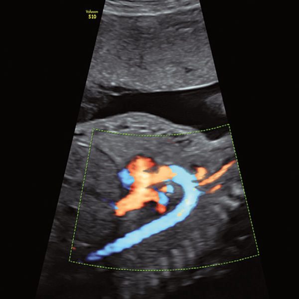 УЗИ АППАРАТ VOLUSON S10 (УНИВЕРСАЛЬНАЯ СИСТЕМА ДЛЯ ЧАСТНОЙ КЛИНИКИ) image