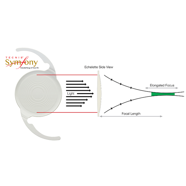 ЛИНЗА С ПРОЛОНГИРОВАННЫМ ФОКУСОМ ИНТРАОКУЛЯРНАЯ (IOL) TECNIS SYMFONY image