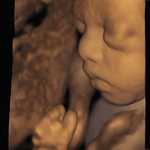 УЗИ АППАРАТ VOLUSON S10 (УНИВЕРСАЛЬНАЯ СИСТЕМА ДЛЯ ЧАСТНОЙ КЛИНИКИ) image