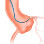 ПРОВОДНИКОВЫЙ КАТЕТЕР HEARTRAIL PTCA image