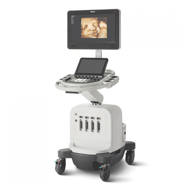 УЛЬТРАЗВУКОВОЙ АППАРАТ AFFINITY 30 image