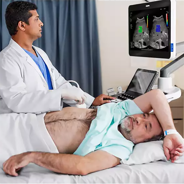 УЛЬТРАЗВУКОВАЯ СИСТЕМА ПРЕМИУМ КЛАССА PHILIPS EPIQ ELITE image