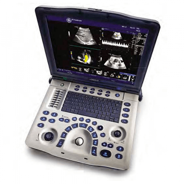 ПОРТАТИВНЫЙ УЗИ АППАРАТ LOGIQ V2 (СРЕДНЕГО КЛАССА) image