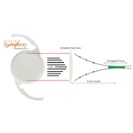 ЛИНЗА С ПРОЛОНГИРОВАННЫМ ФОКУСОМ ИНТРАОКУЛЯРНАЯ ТОРИЧЕСКАЯ (IOL) TECNIS SYMFONY TORIC image