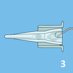 КАРТРИДЖИ ДЛЯ ВВЕДЕНИЯ ЛИНЗ image