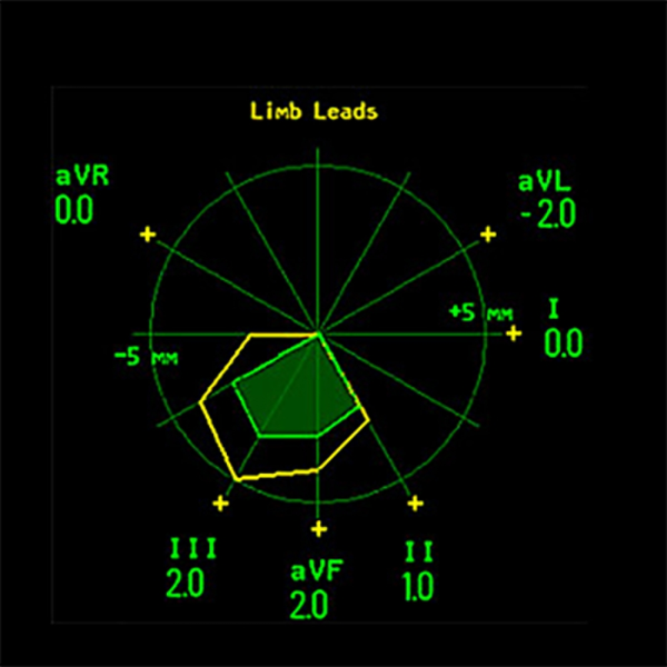 КАРТА СЕГМЕНТА ST image