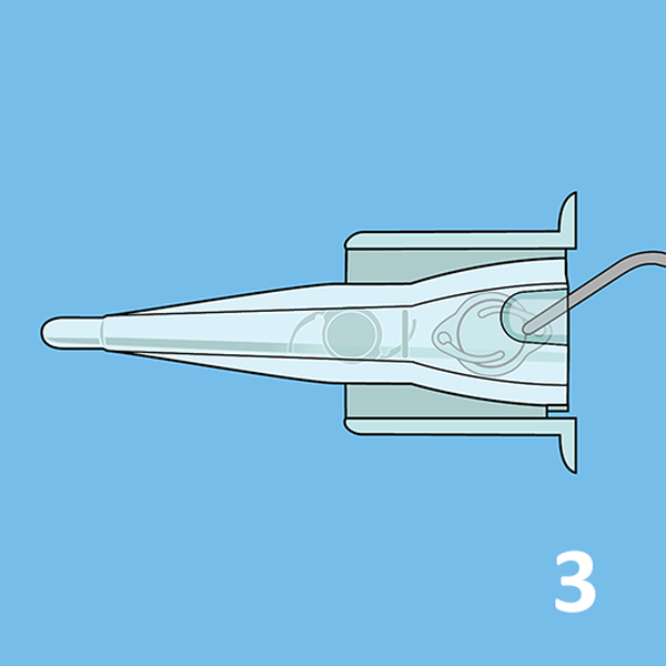 КАРТРИДЖИ ДЛЯ ВВЕДЕНИЯ ЛИНЗ image