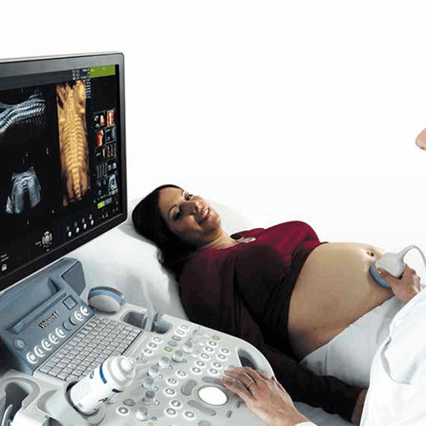 УЗИ АППАРАТ VOLUSON S8 (ВЫСОКИЙ ПОТОК ПАЦИЕНТОВ) image