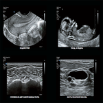 УЛЬТРАЗВУКОВОЙ АППАРАТ EPIQ7 image