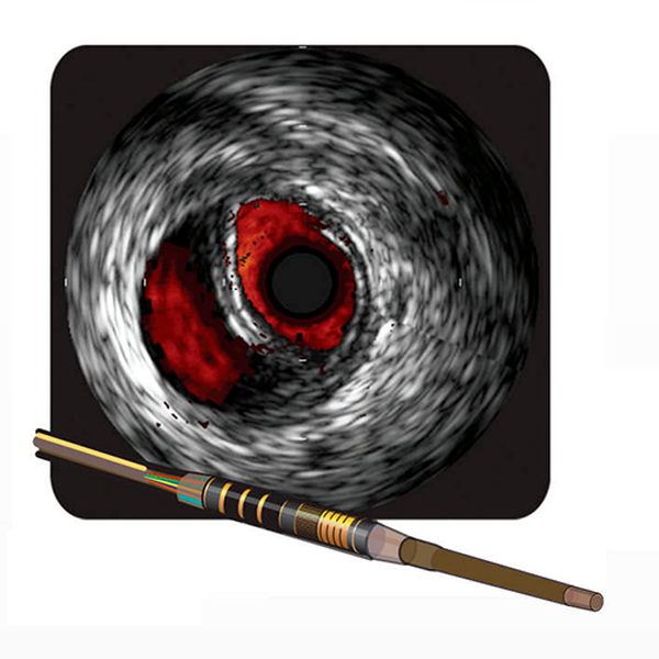 ЦИФРОВЫЕ КАТЕТЕРЫ ДЛЯ ПЕРИФЕРИЧЕСКИХ ВНУТРИСОСУДИСТЫХ УЛЬТРАЗВУКОВЫХ ИССЛЕДОВАНИЙ VISIONS image