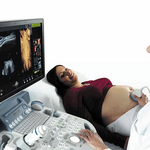 УЗИ АППАРАТ VOLUSON S8 (ВЫСОКИЙ ПОТОК ПАЦИЕНТОВ) image