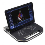 ПОРТАТИВНЫЙ УЗИ АППАРАТ VIVID iq (КАРДИО) image