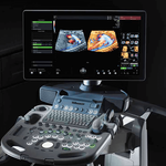 УЗИ АППАРАТ VOLUSON S8 (ВЫСОКИЙ ПОТОК ПАЦИЕНТОВ) image