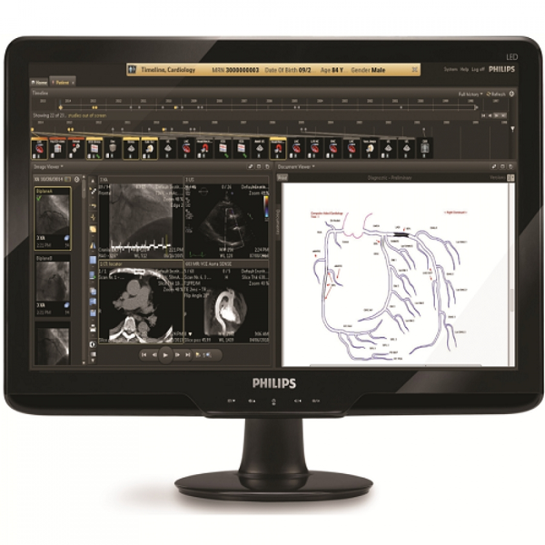 PHILIPS INTELLSPASE CARDIOVASCULAR image