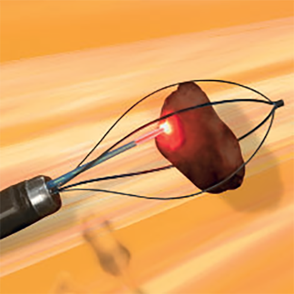 НИТИНОЛОВАЯ КОРЗИНА ДЛЯ ЛИТОЭКСТРАКЦИИ И ЛИТОТРИПСИИ ESCAPE image