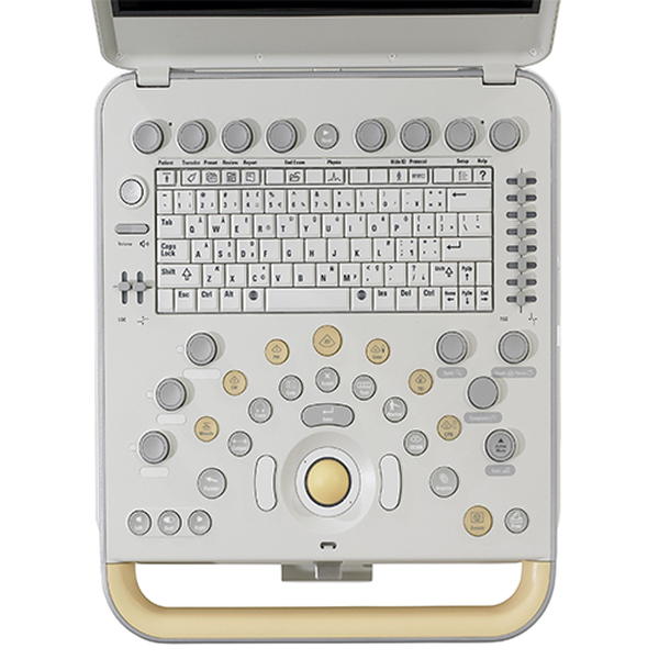 УЛЬТРАЗВУКОВОЙ АППАРАТ CX50 image