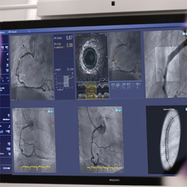 СИСТЕМА СИНХРОНИЗАЦИИ ИЗОБРАЖЕНИЯ SYNCVISION image