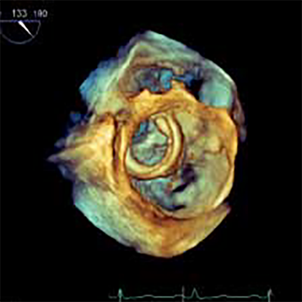 УЛЬТРАЗВУКОВОЙ АППАРАТ CX50 image