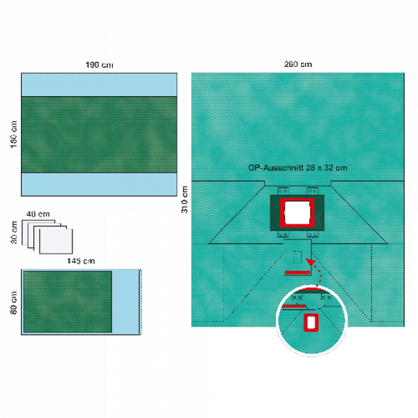 КОМПЛЕКТ ОПЕРАЦИОННОГО БЕЛЬЯ ДЛЯ ОПЕРАЦИИ НА ПРЯМОЙ КИШКЕ 1 image
