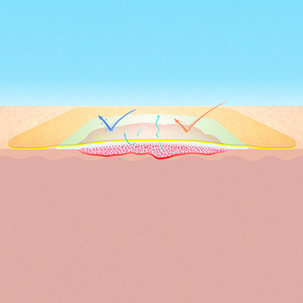 СУПРАСОРБ P (SUPRASORB P) ПОЛИУРЕТАНОВАЯ ГУБКА image