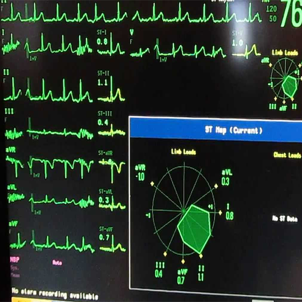 КАРТА СЕГМЕНТА ST image