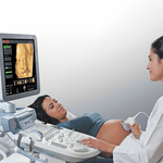 УЗИ АППАРАТ VOLUSON P8 (ДЛЯ НЕБОЛЬШИХ КАБИНЕТОВ) image