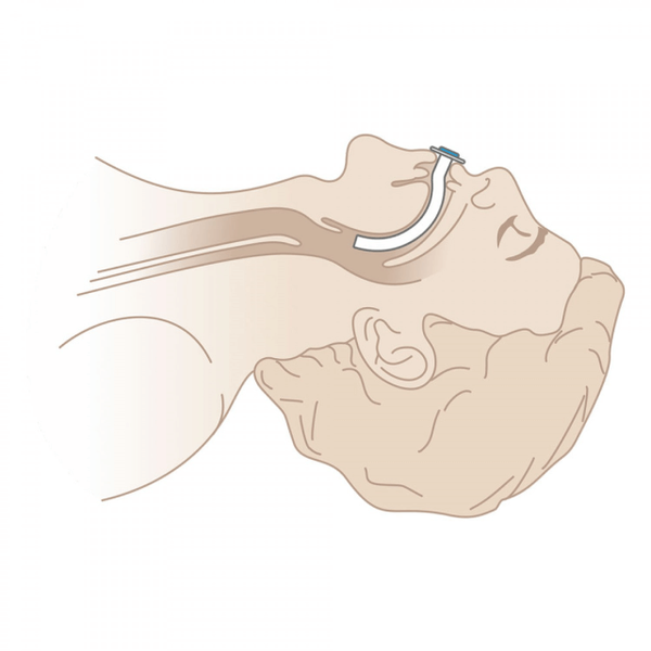 ВОЗДУХОВОДЫ ОРОФАРИНГЕАЛЬНЫЕ image