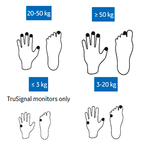 МНОГОРАЗОВЫЙ ДАТЧИК ПУЛЬСОКСИМЕТРИЧЕСКИЙ ВЗРОСЛЫЙ/ДЕТСКИЙ/НЕОНАТАЛЬНЫЙ TS-SE-3 image
