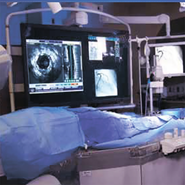 VOLCANO CORE ИНТЕГРИРОВАННАЯ ВЕРСИЯ (РЕГИСТРАЦИЯ ВСУЗИ IFR И FFR) image