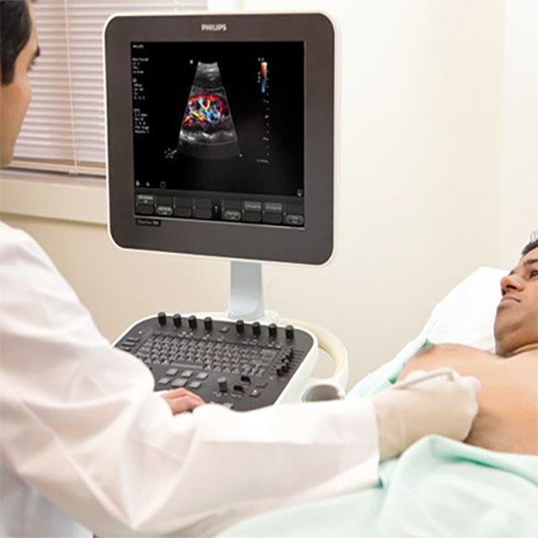 УЛЬТРАЗВУКОВОЙ АППАРАТ CLEARVUE 350 image