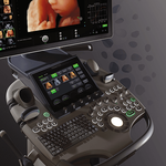 УЗИ АППАРАТ VOLUSON S10 (УНИВЕРСАЛЬНАЯ СИСТЕМА ДЛЯ ЧАСТНОЙ КЛИНИКИ) image