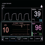 МОНИТОР ДЫХАТЕЛЬНЫХ ФУНКЦИЙ (КАПНОГРАФ-ПУЛЬСОКСИМЕТР) CAPNOSTREAM 20 image