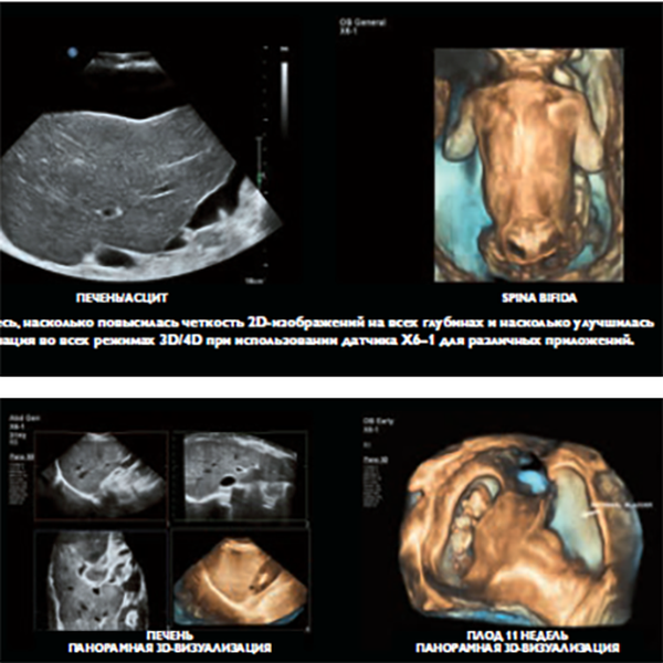 УЛЬТРАЗВУКОВОЙ АППАРАТ EPIQ7 image
