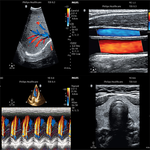 УЛЬТРАЗВУКОВОЙ АППАРАТ CLEARVUE 850 image