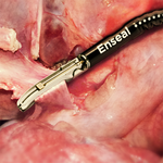 ИНСТРУМЕНТ ДЛЯ ДИССЕКЦИИ И ЛИГИРОВАНИЯ ИЗГИБАЕМЫЙ ENSEAL G2 ART image