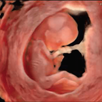 УЗИ АППАРАТ (ЭКСПЕРТНЫЙ УРОВЕНЬ ЖЕНСКОГО ЗДОРОВЬЯ) VOLUSON E10 image