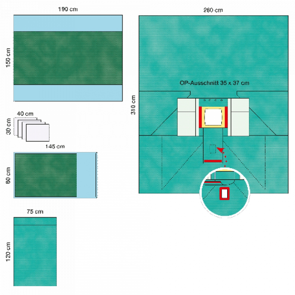 КОМПЛЕКТ ОПЕРАЦИОННОГО БЕЛЬЯ ДЛЯ ОПЕРАЦИИ НА ПРЯМОЙ КИШКЕ 2 image