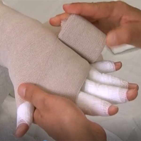 ВИДЕОКУРС №2 БИНТОВАНИЕ РУКИ image