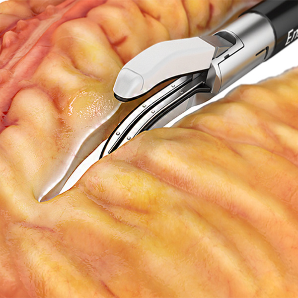 ИНСТРУМЕНТ ДЛЯ ДИССЕКЦИИ И ЛИГИРОВАНИЯ ДЛЯ ОТКРЫТОЙ ХИРУРГИИ ENSEAL X1 LARGE JAW image