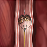 КОРЗИНЫ С ПЛОСКИМИ СТРУНАМИ SEGURA image