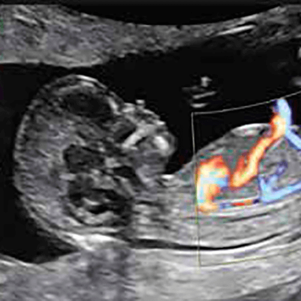 УЗИ АППАРАТ (ЭКСПЕРТНЫЙ УРОВЕНЬ ЖЕНСКОГО ЗДОРОВЬЯ) VOLUSON E10 image