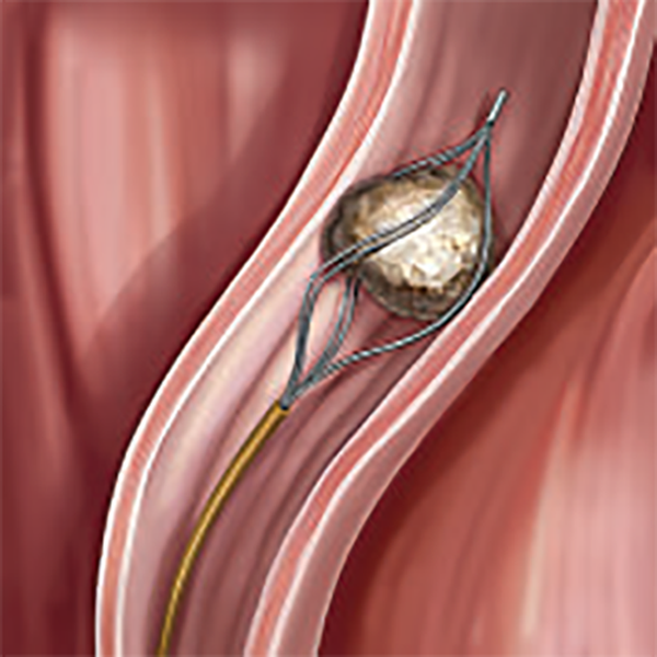 СПИРАЛЕВИДНЫЕ КОРЗИНЫ С ПАРНЫМИ СТРУНАМИ GEMINI image