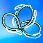 ТОЛКАЕМЫЕ СПИРАЛИ ДЛЯ ЭМБОЛИЗАЦИИ (РАЗЛИЧНЫЕ) image