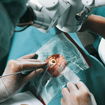 СИСТЕМА ДЛЯ ДРЕНИРОВАНИЯ СЛЕЗЫ ПРО-ОФТА image