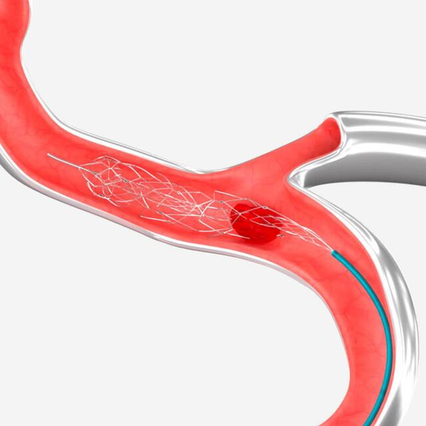 УСТРОЙСТВО ДЛЯ ВНУТРИСОСУДИСТОЙ ТРОМБОЭКТОМИИ EMBOTRAP III image