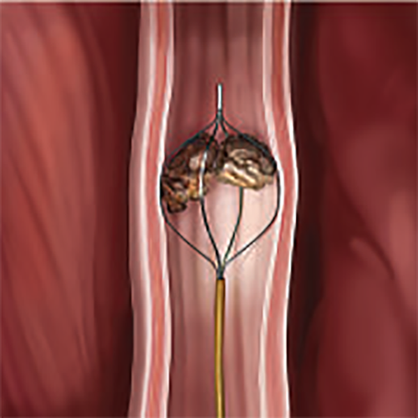 КОРЗИНЫ С ПЛОСКИМИ СТРУНАМИ SEGURA image
